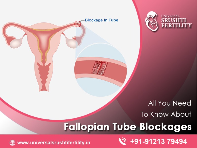 Best Fertility Hospital in Hyderabad